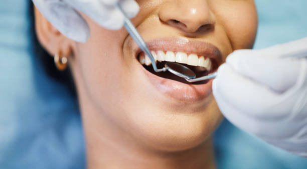 Best Dentist for Tooth Abscess  in Perkasie, PA